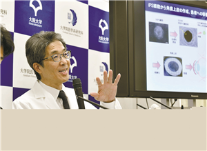 Một nhóm nghiên cứu của đại học Osaka cho biết đã tiến hành cấy ghép mô giác mạc đầu tiên trên thế giới sử dụng tế bào gốc có nguồn gốc nhân tạo.